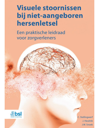Visuele stoornissen bij niet-aangeboren 